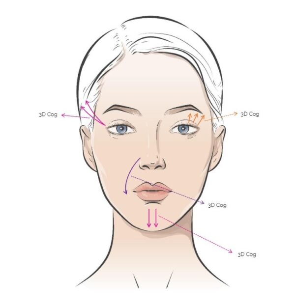 Rainbow Threads Rainbow 3D Cog 4x draadlift dermal filler oreon life science explanation 2