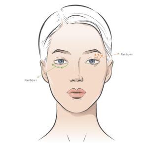 Rainbow Threads Rainbow Eye 4x draadlift dermal filler oreon life science explanation 2