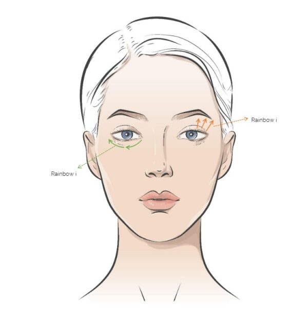 Rainbow Threads Rainbow Eye 4x draadlift dermal filler oreon life science explanation 2